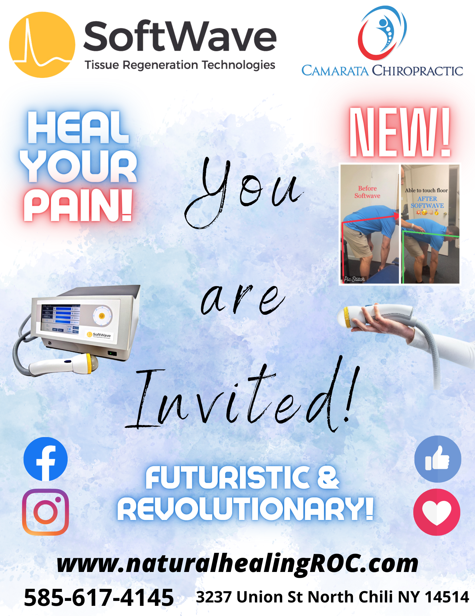 Unveiling the Future of Pain Relief: Why SoftWave Therapy is Gaining Popularity in Rochester, NY