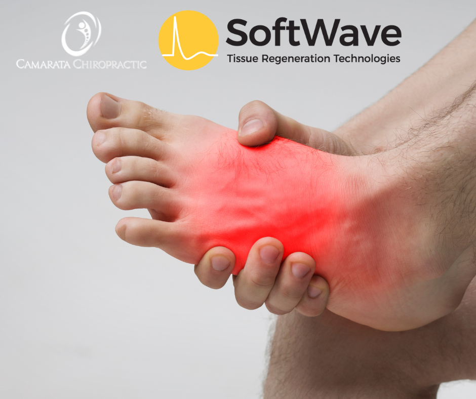 Foot Arthritis and the Transformative Power of SoftWave Therapy at Camarata Chiropractic