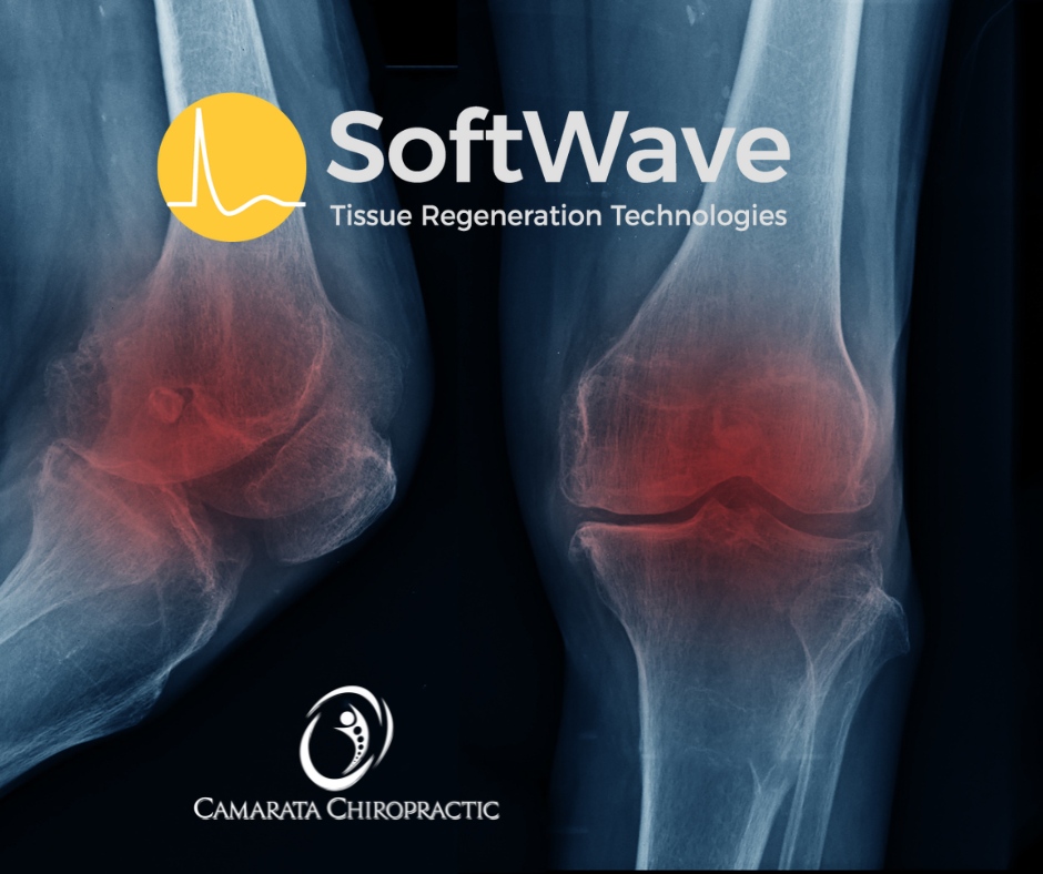 Do Gel Injections Actually Work?! – What’s a Better Option for Your Knee Pain?