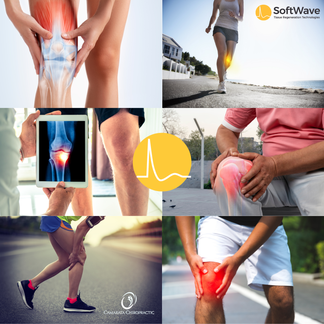 A Breakthrough for Knee Pain Relief, Strength, and Mobility: SoftWave Therapy in Chili, NY