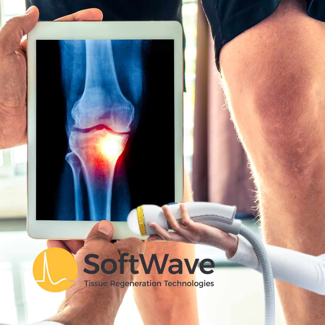 Unveiling the Mystery of Medial Knee Pain: SoftWave Therapy as Your First Line of Defense