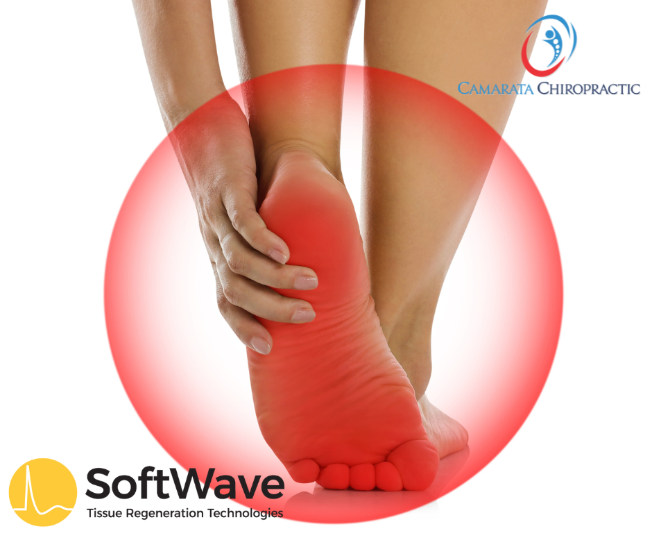 Transforming Plantar Fasciitis Treatment with Electryohydraulic Supersonic Acoustic Waves