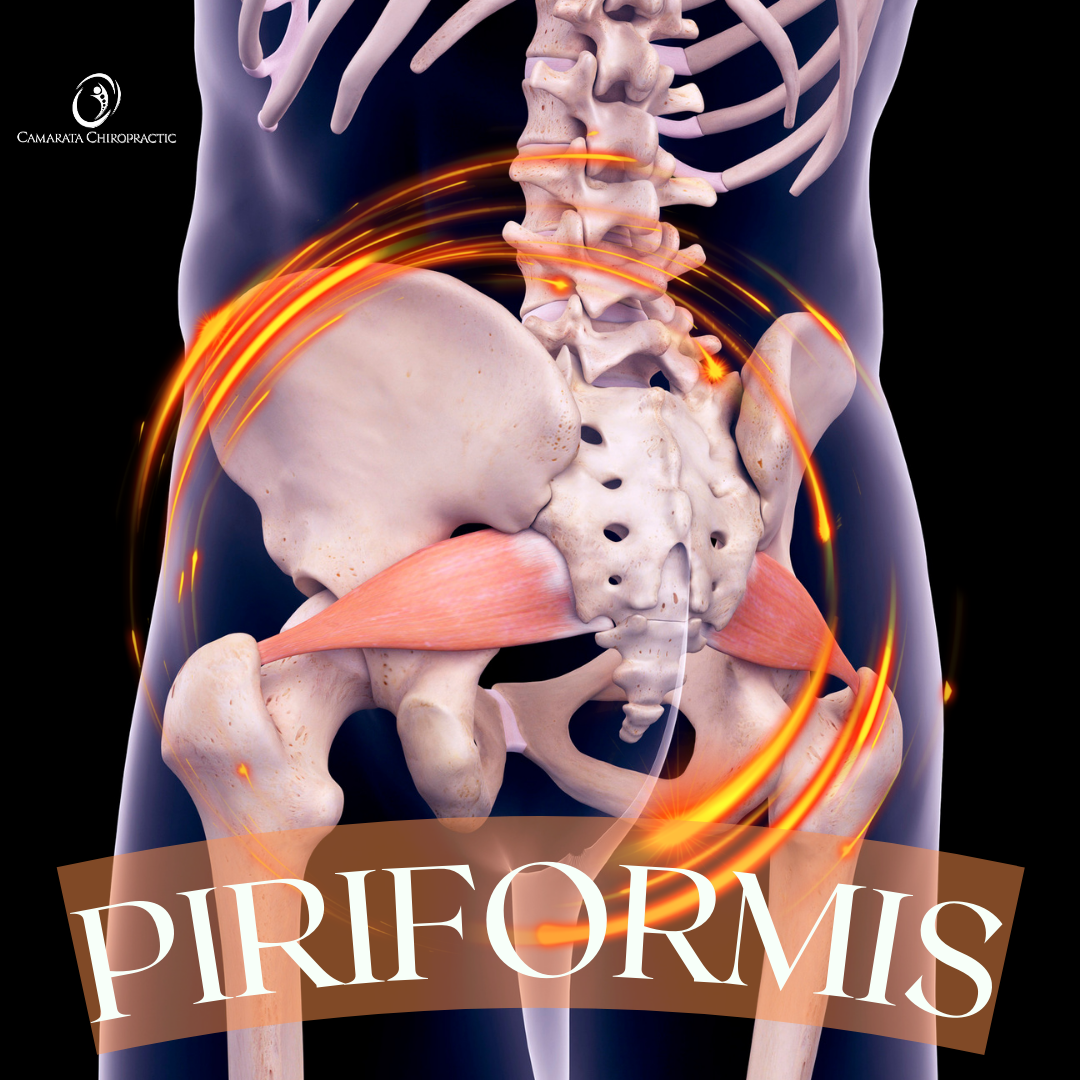 Breaking Free from Piriformis Syndrome: The Power of SoftWave Therapy
