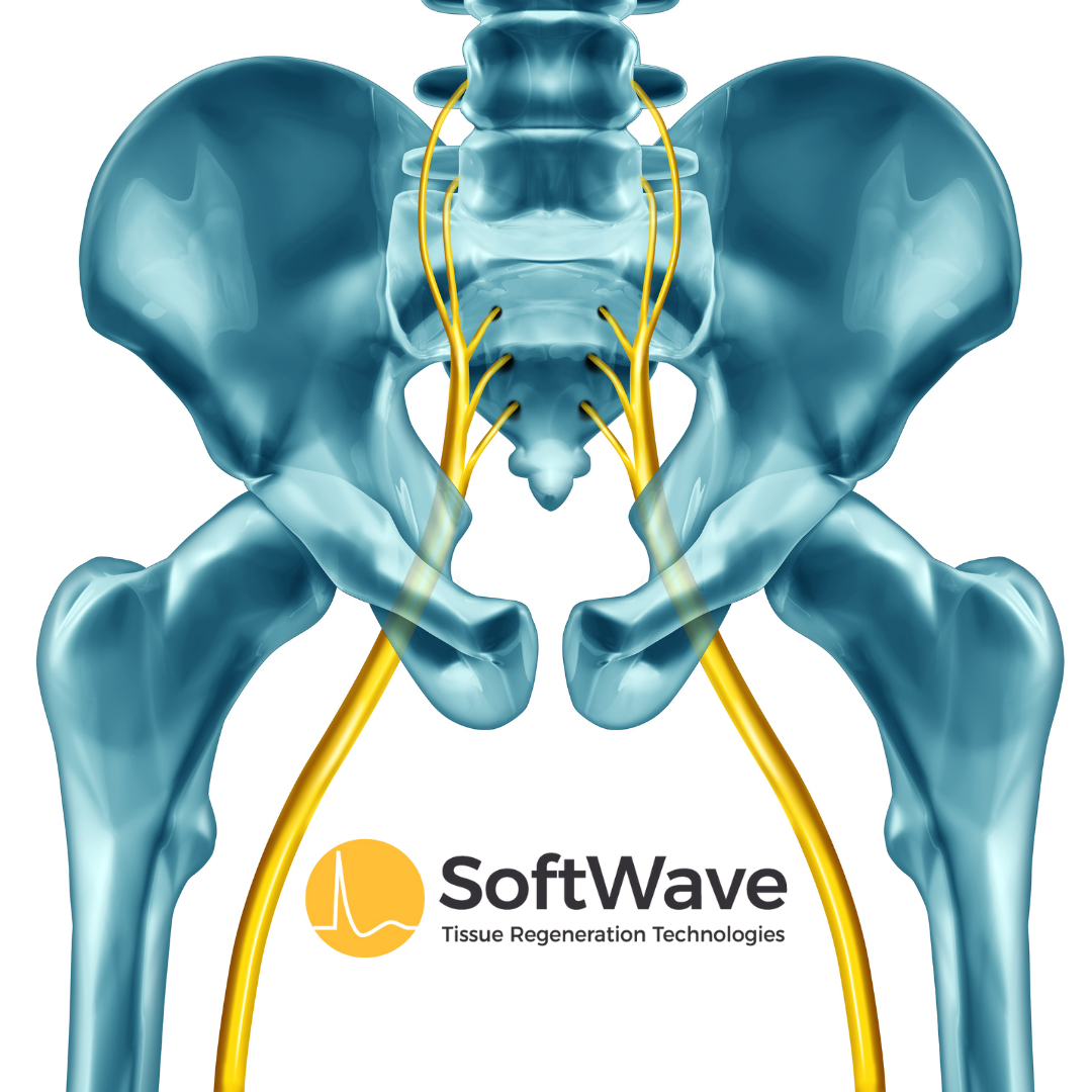 Can SoftWave Therapy Provide Lasting Relief for Sciatica Pain?