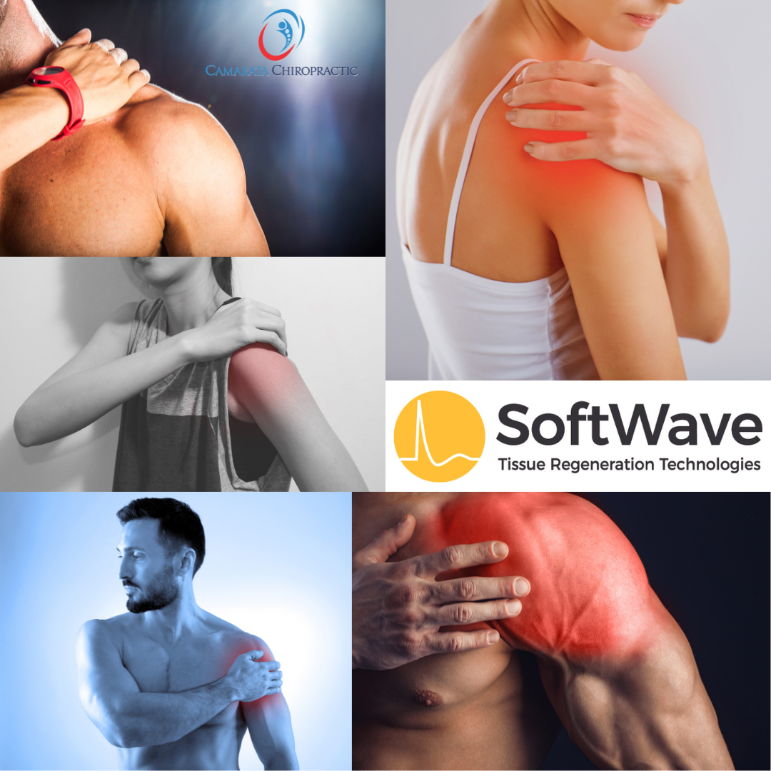 Revolutionizing Shoulder Pain Relief: The Superiority of SoftWave Therapy