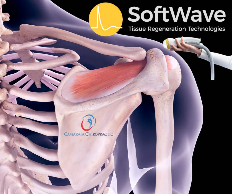 Rediscover Shoulder Mobility: SoftWave Therapy for Supraspinatus Injury