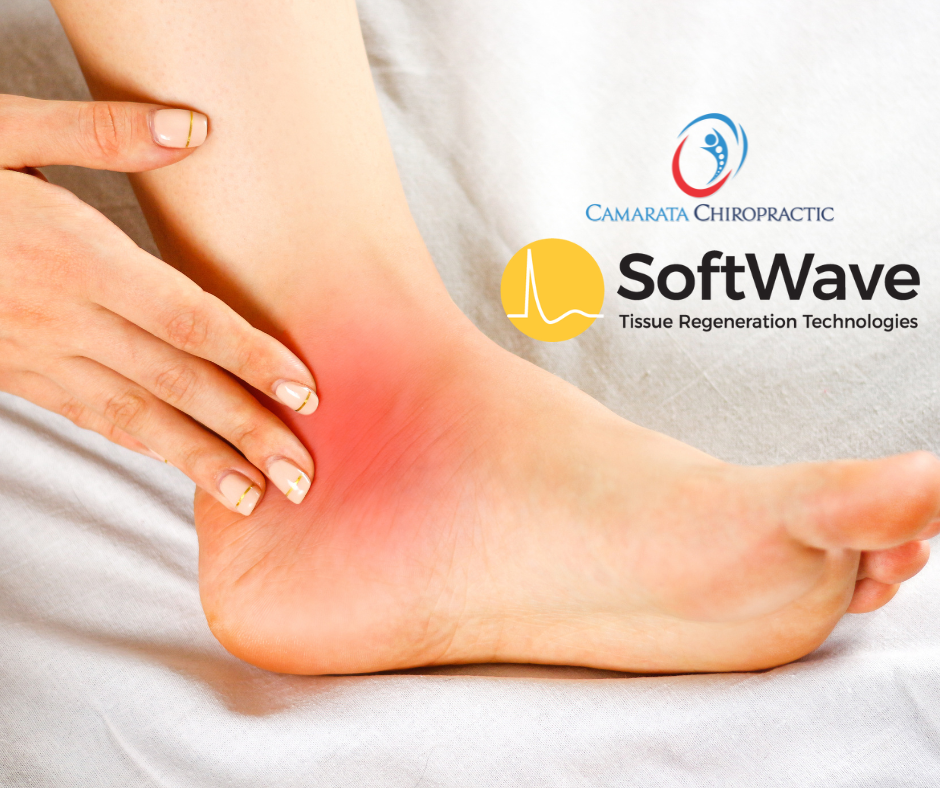 Tarsal Tunnel Syndrome and SoftWave Therapy: A New Hope for Foot Pain Relief at Camarata Chiropractic