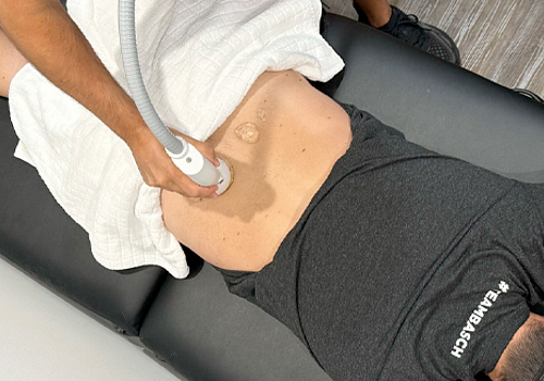 SoftWave Reviews in Rochester: Real Results and Patient Success Stories