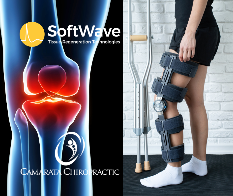 Before You Say Yes to Surgery… Read This About SoftWave Therapy in Rochester, NY
