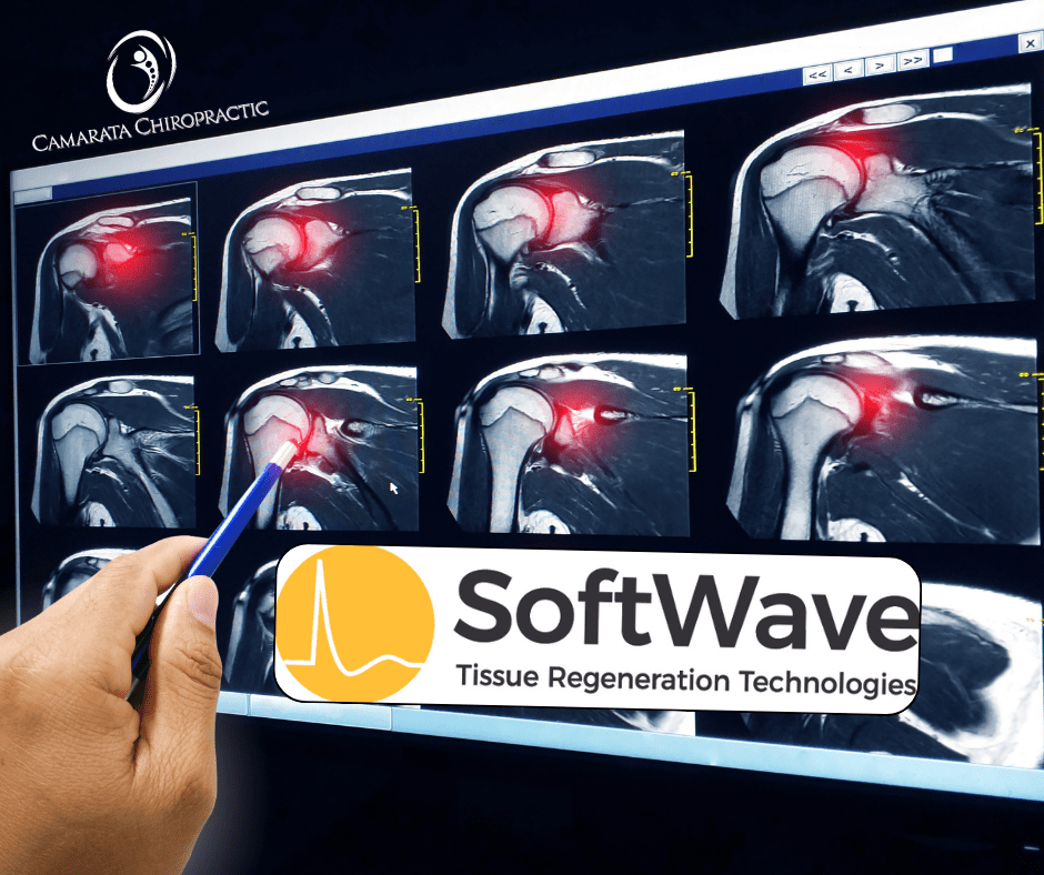 Rotator Cuff and Shoulder Tendinopathy in Rochester, NY: A Non-Surgical SoftWave Approach Rotator Cuff and Shoulder Tendinopathy in Rochester, NY: A Non-Surgical SoftWave Approach